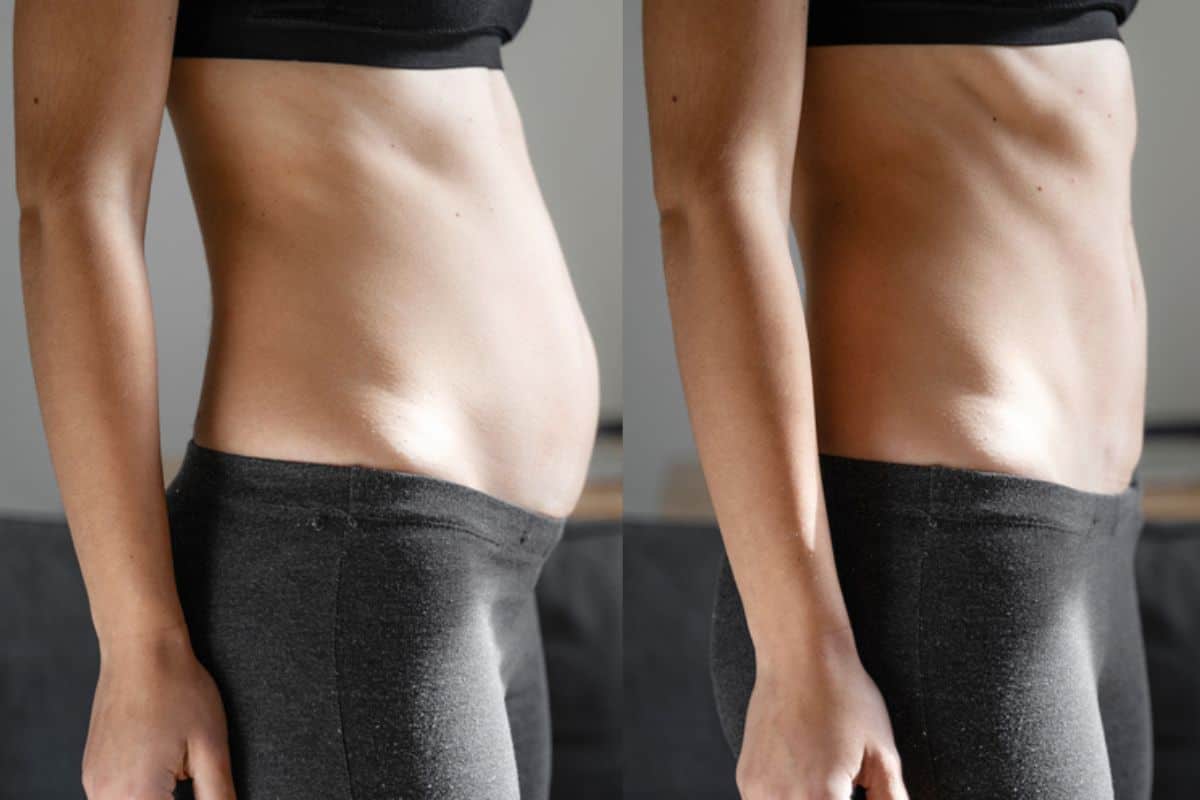 Post-Pregnancy: What Happens to Your Abdominal Muscles After Birth Kirkstall
