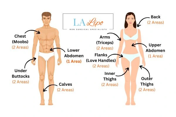 LA LIPO Cryolipolysis Areas Kirkstall