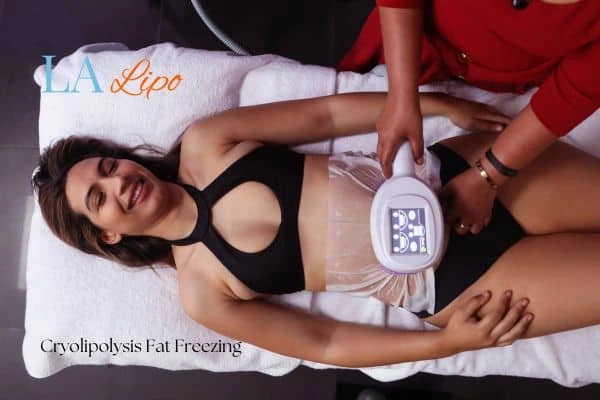 woman getting cryolipolysis Kirkstall