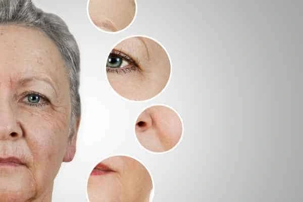 HIFU Facelift Kirkstall from LA LIPO