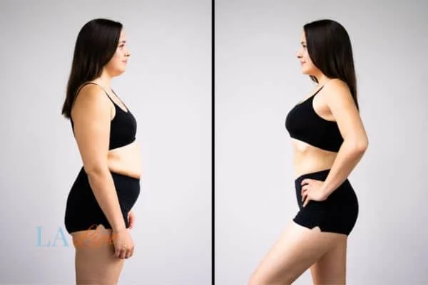 link between body image and mental health Kirkstall
