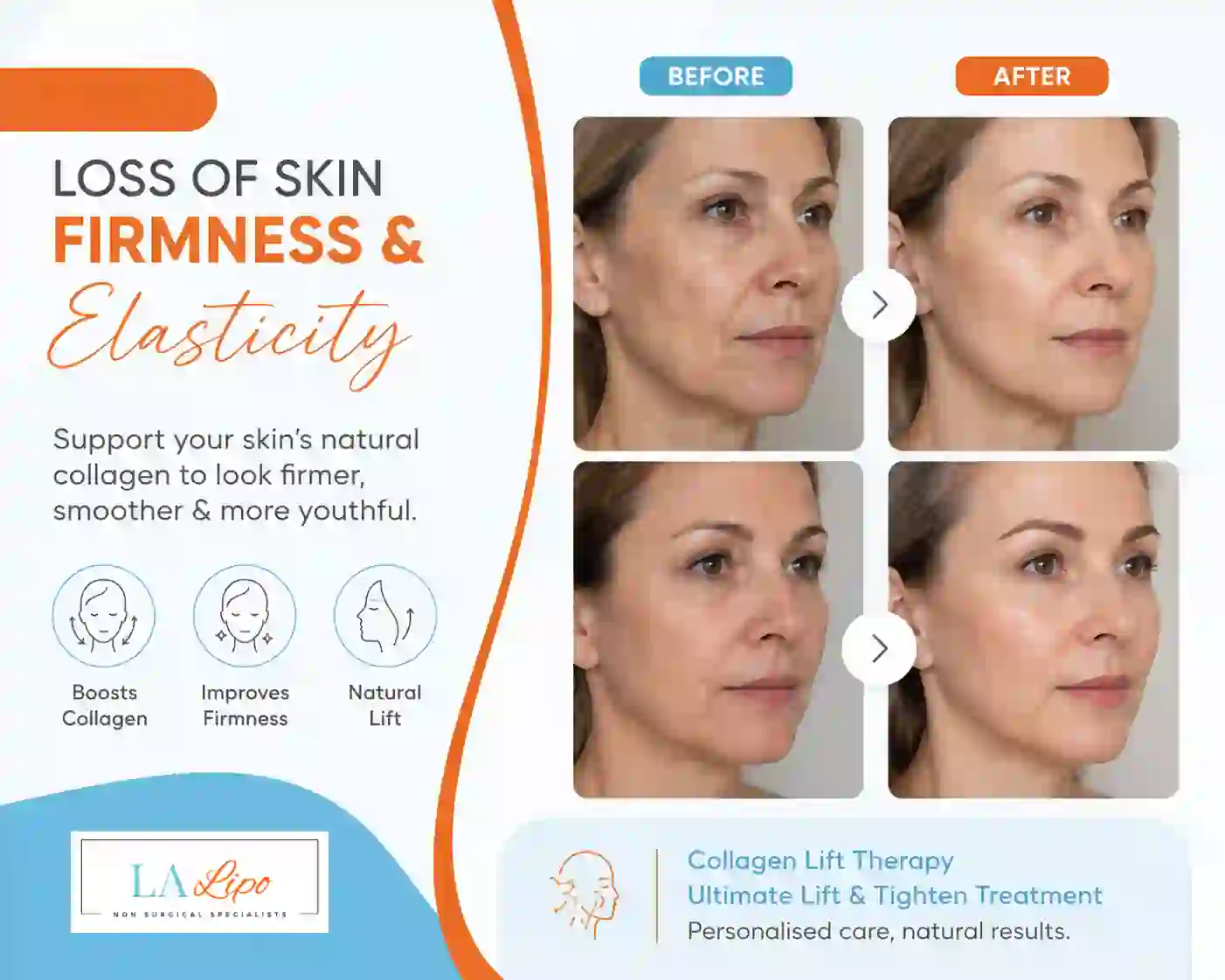 Sign #7: Loss of Skin Firmness and Elasticity Kirkstall